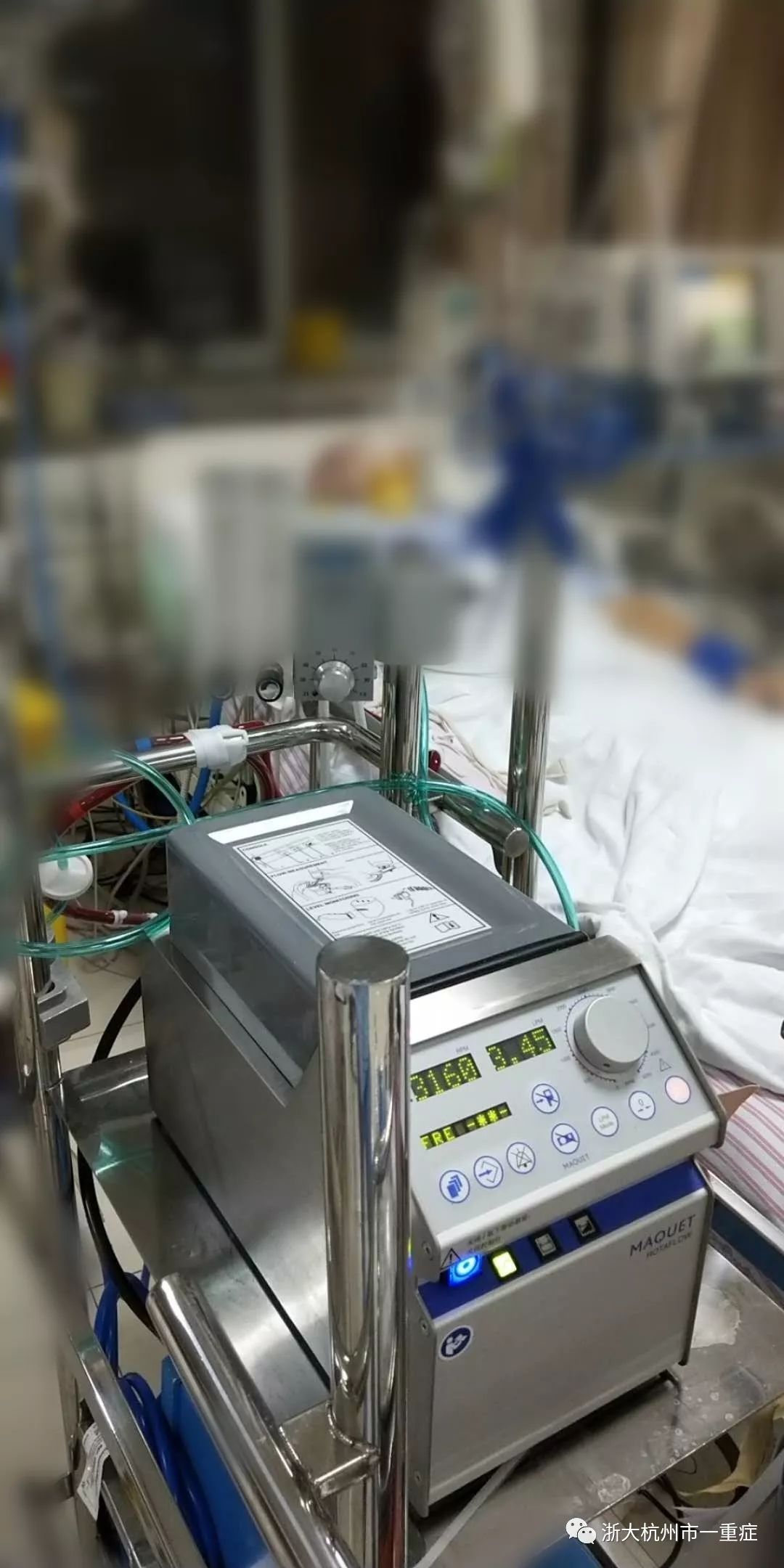 Exmo(ecmo是什么仪器)