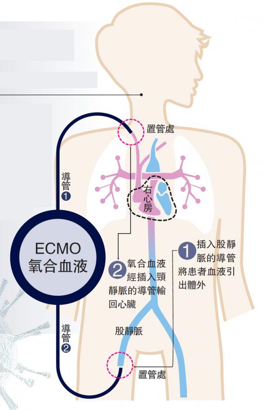 Exmo(exmor)