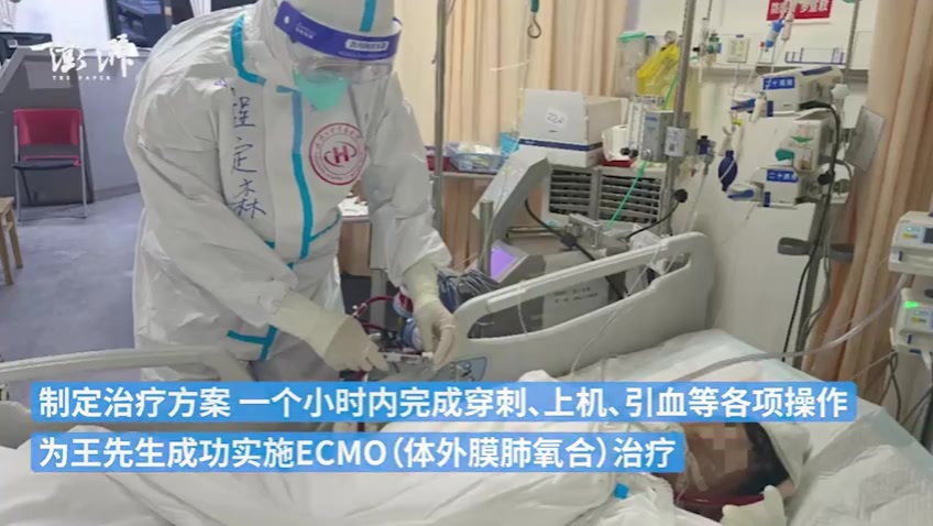Exmo(exmorr5摄像机)